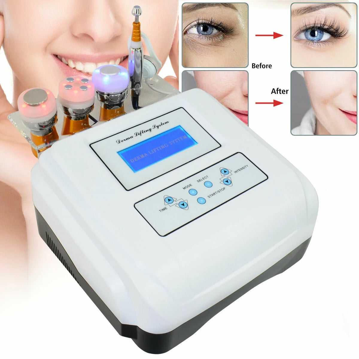 Mesotherapy Sculpting Electroporation Spa 40K Cool Fat Mesotherapy Machine Machine RF Needle No Slimming Cryo Cryo Anqidi Body