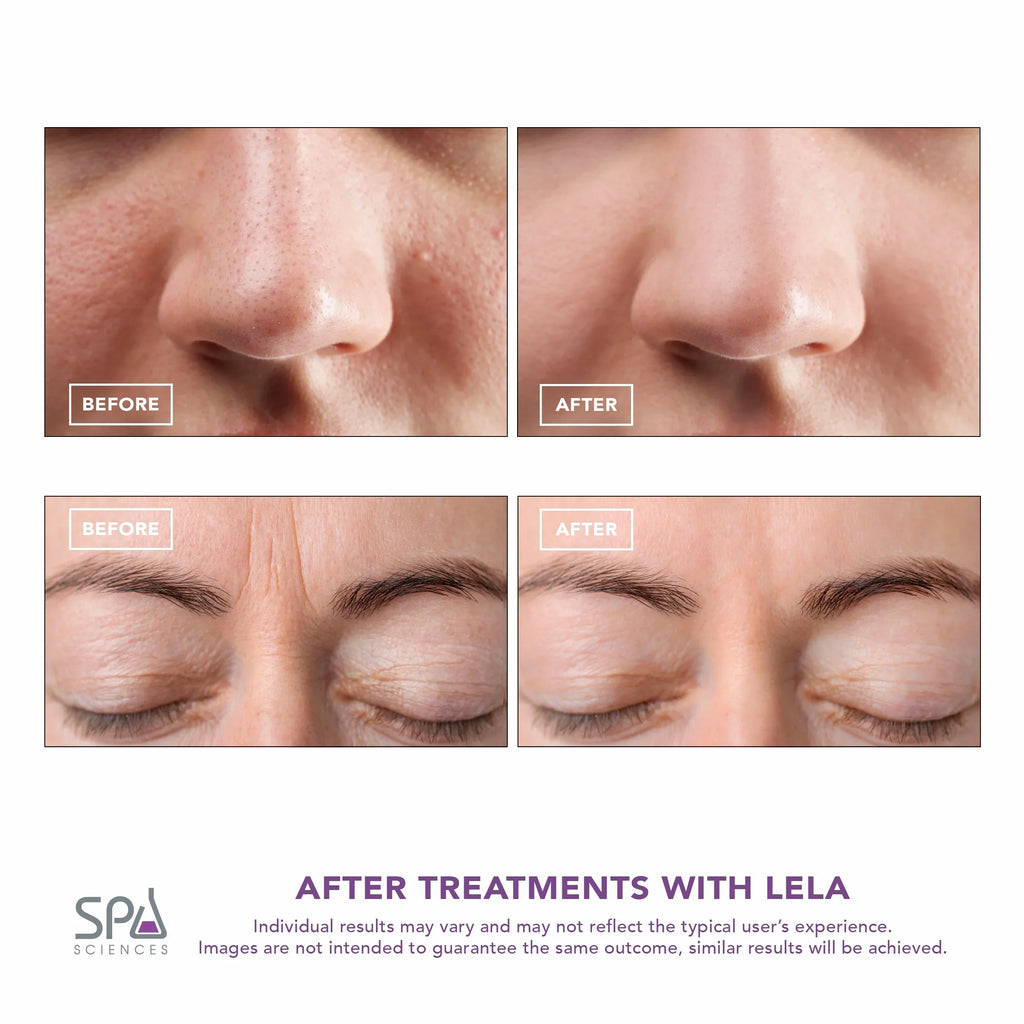 LELA Spatula, Mint Spa Sciences Skin