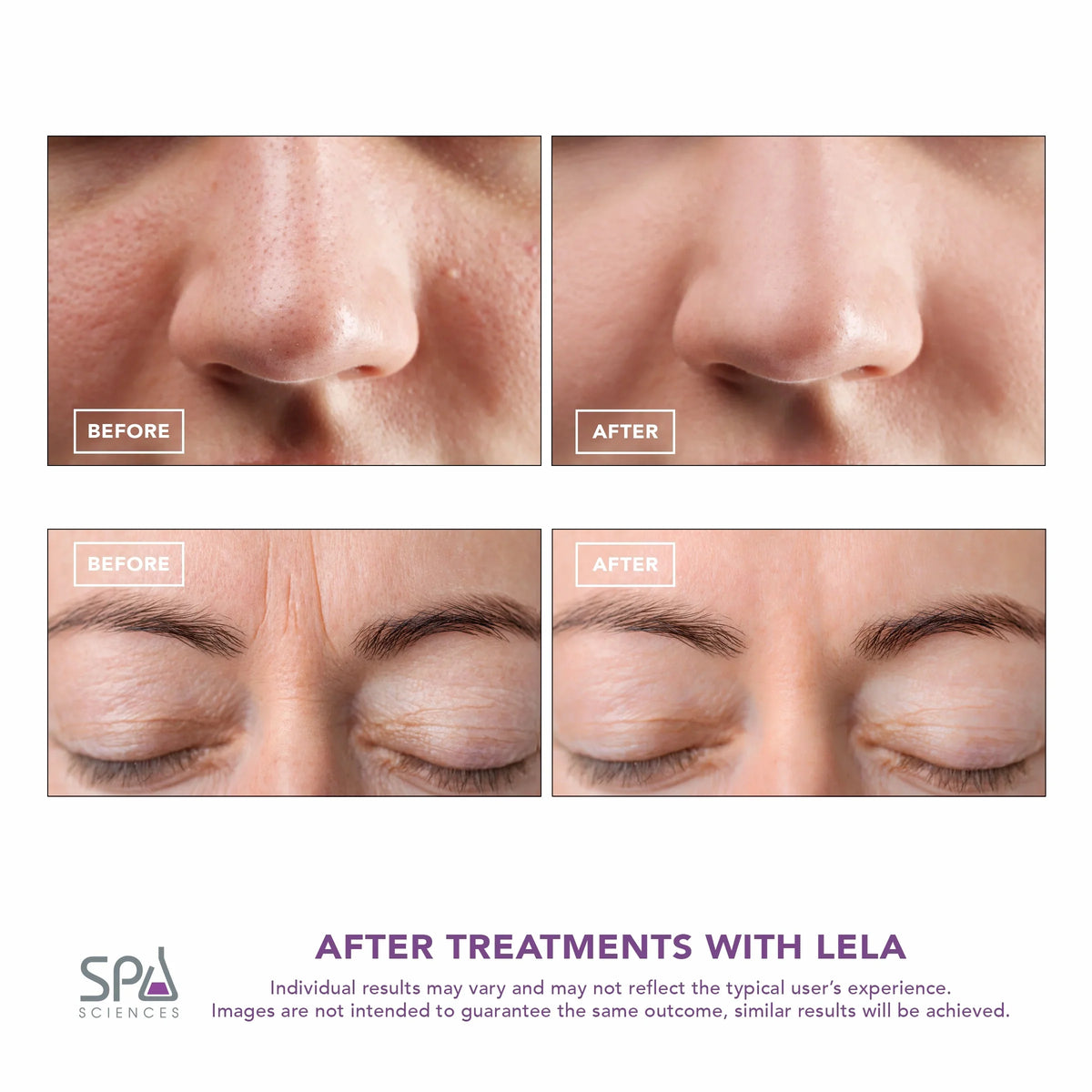 LELA Spatula, Mint Spa Sciences Skin