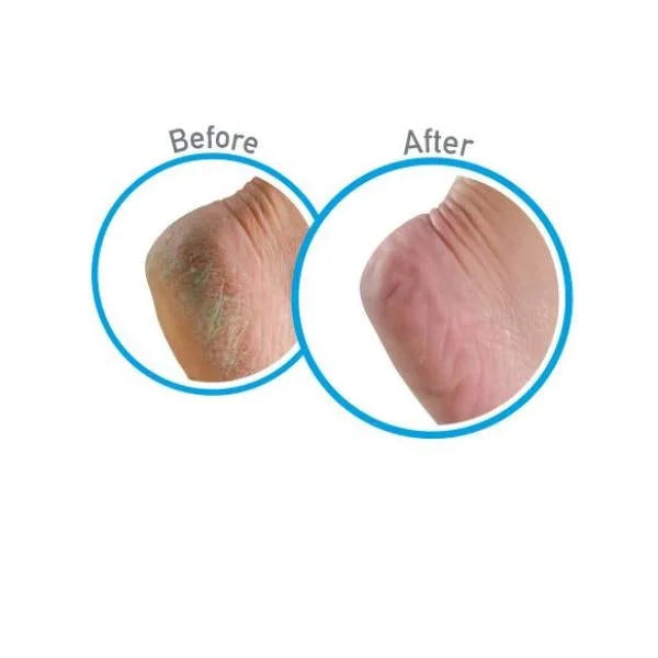 Foot (5-Pack) 3oz. Healthy Cream Feet
