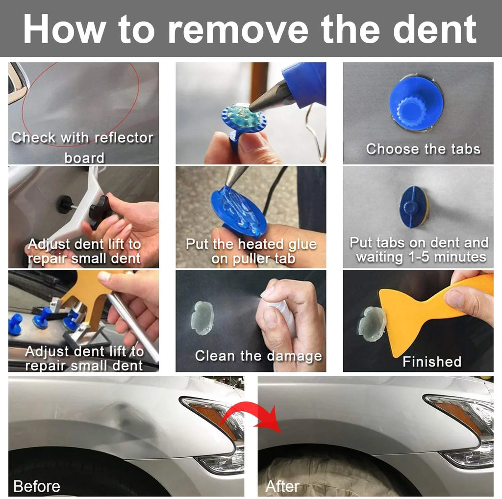 Dent Kits Dent PDR K06 Puller Bridge with DIY kit, Dent Paintless - Car Repair Auto Puller GLISTON Golden DENT Removal