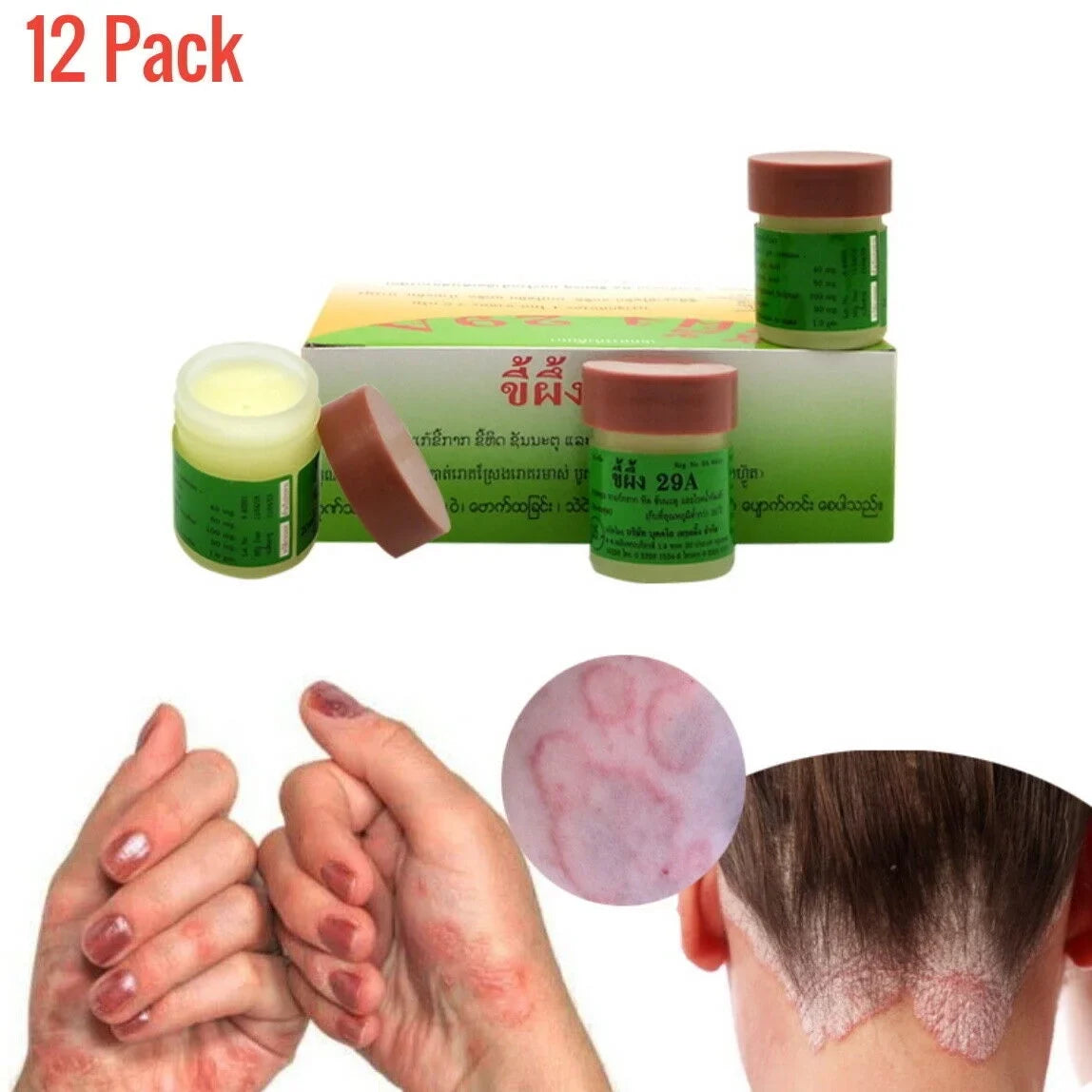 '- Natural Natural Herp. [J] Support Jars Athletes Ft. Sca[b]ies - Relief - - Cream - Herbal - - Fast - Itch [R]ingworm 12 Itch [O]intment ock