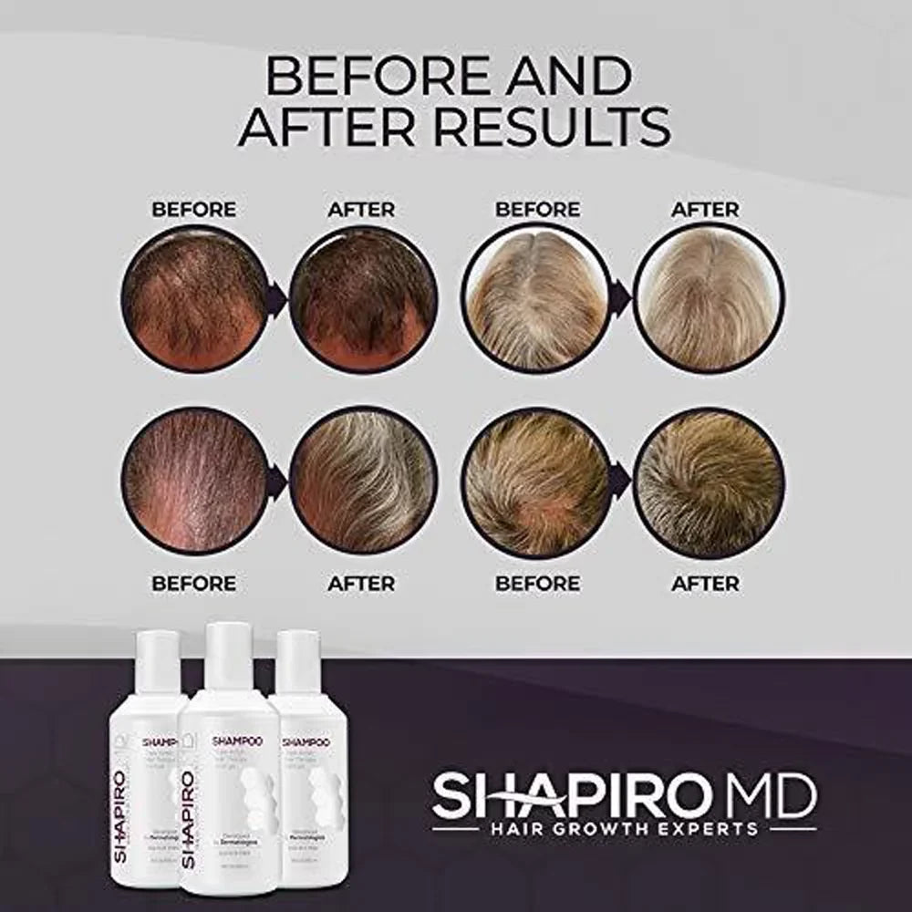 Thinning 8 Month) Shapiro Hair DHT ounce Shampoo, MD for Vegan Formula Hair, Loss (1 Fighting